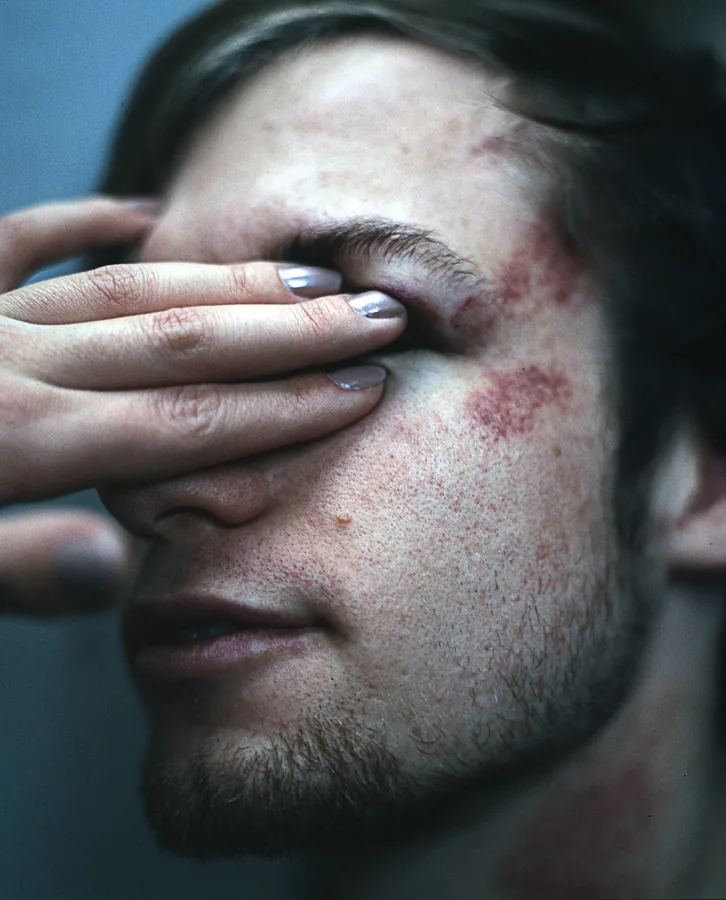 I Was Hurted — image 3