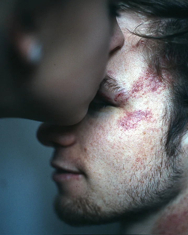 I Was Hurted — image 4